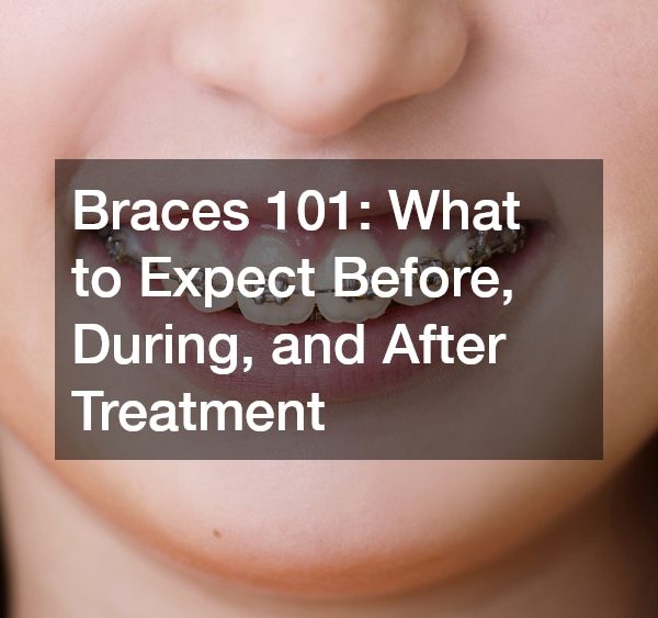 Braces 101 What to Expect Before, During, and After Treatment