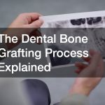 The Dental Bone Grafting Process Explained