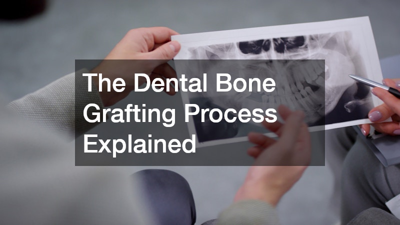The Dental Bone Grafting Process Explained