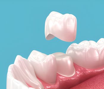 dental crown detached from a shaved tooth